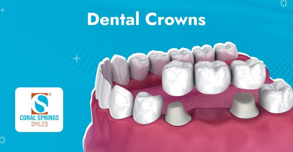Dental crowns in Coral Springs FL