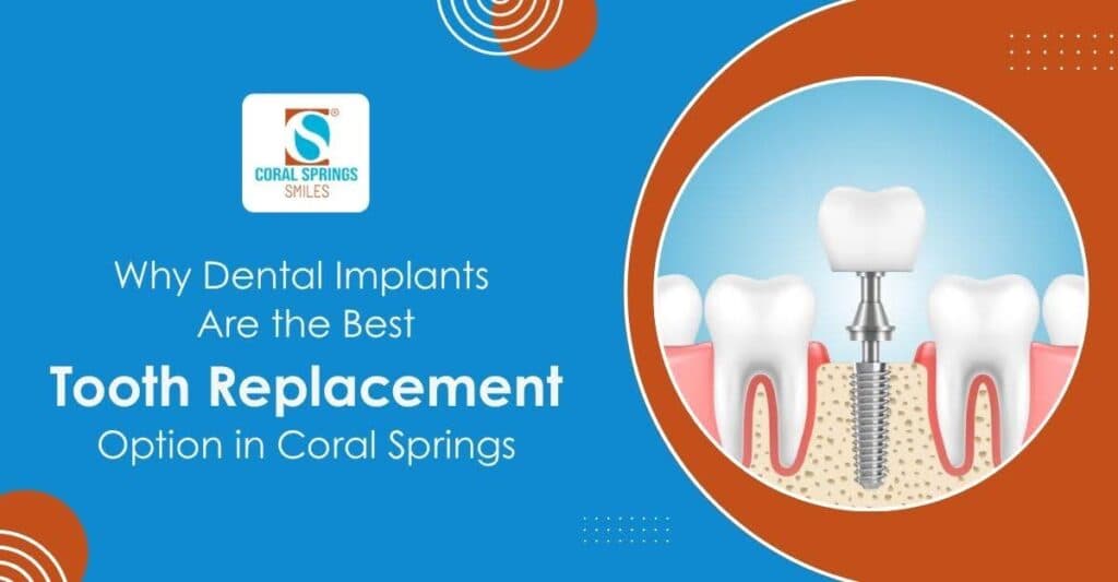 Dental implants in Coral Springs FL