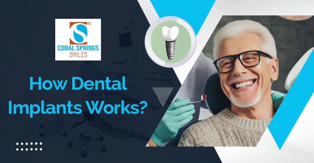 How Do Dental Implants Work?