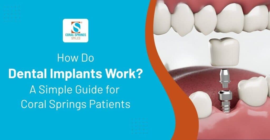 How dental implants work in Coral Springs