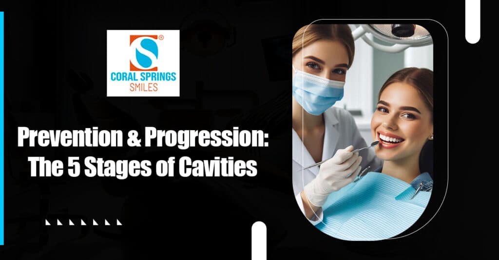 Prevention and progression of the 5 stages of cavities