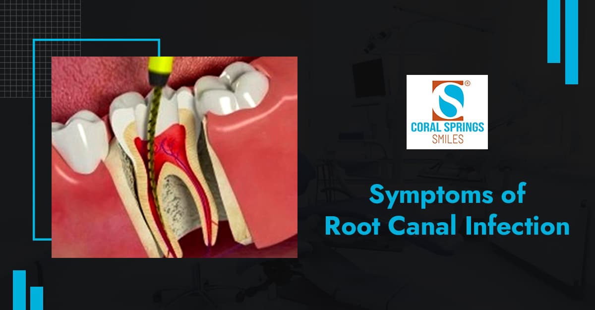 Root Canal Infection: Signs Your Tooth Needs Attention Again