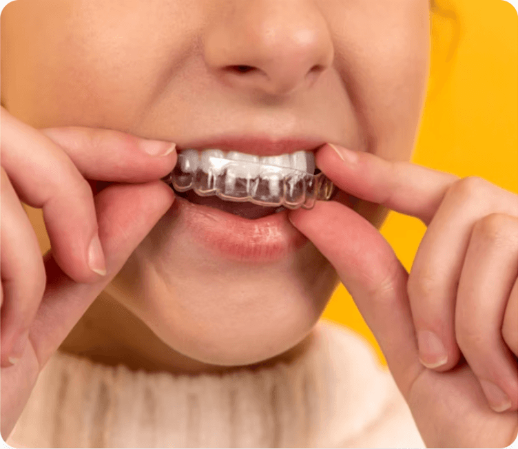 Patient wearing a clear dental aligner