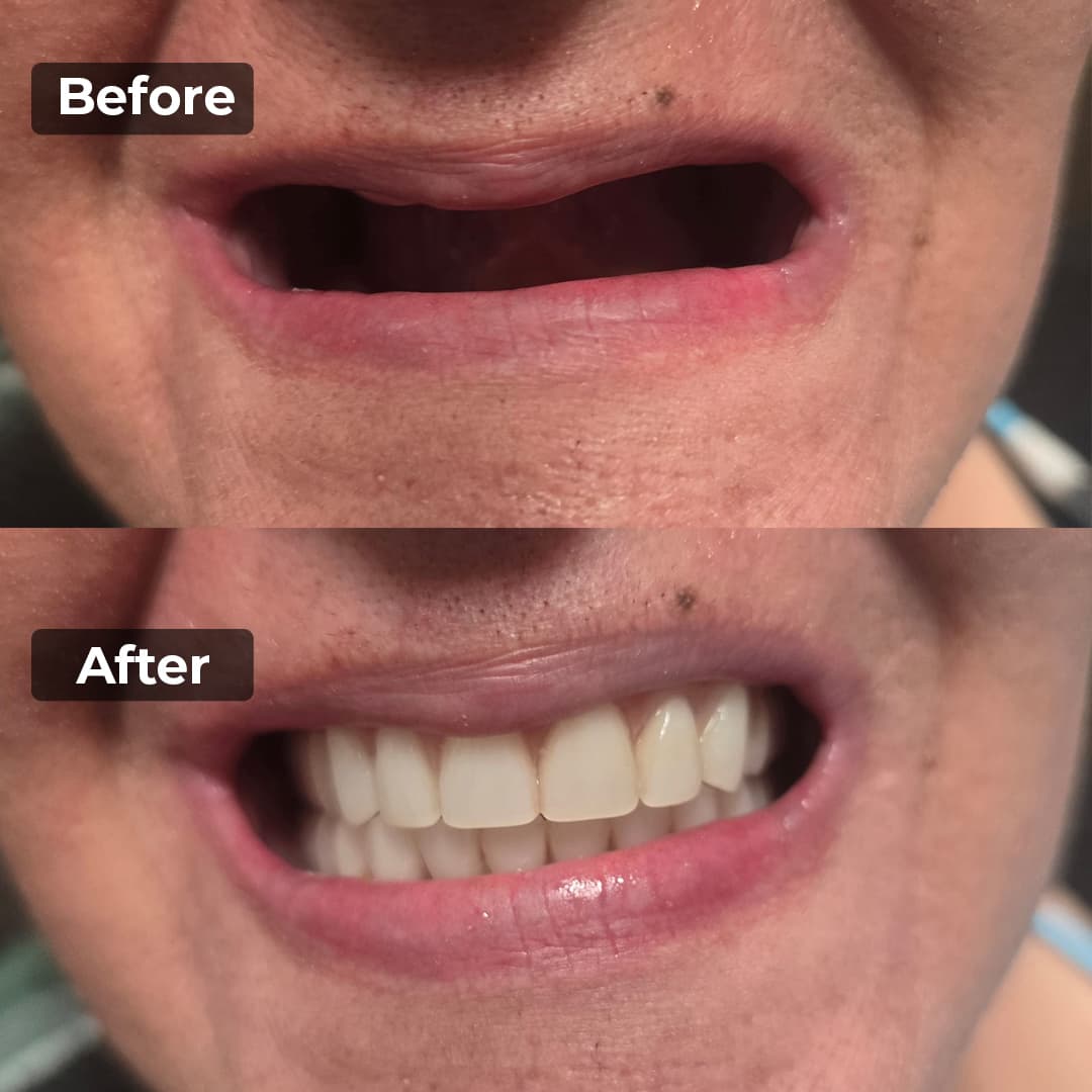 Smile transformation gallery photo 1 of 27