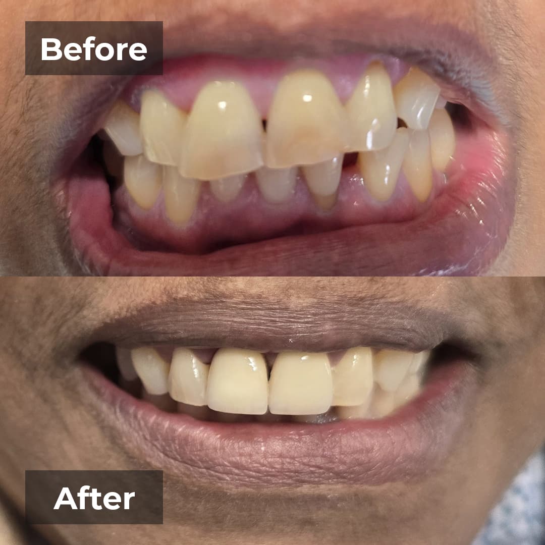 Smile transformation gallery photo 10 of 27