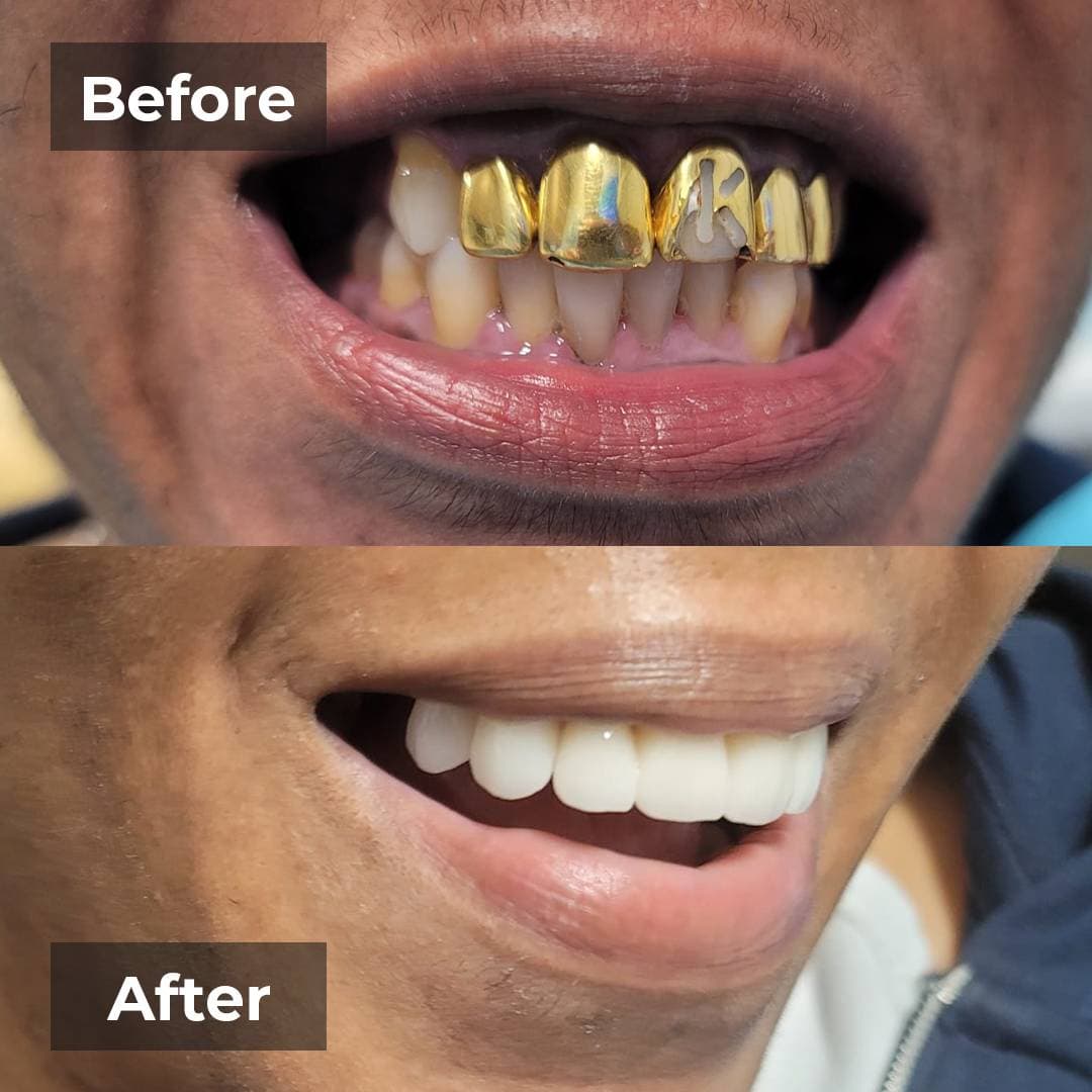 Smile transformation gallery photo 11 of 27