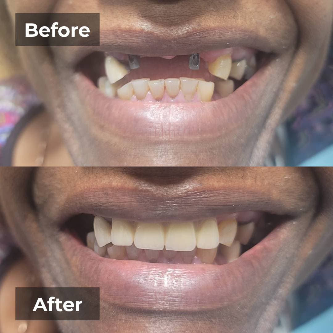 Smile transformation gallery photo 12 of 27
