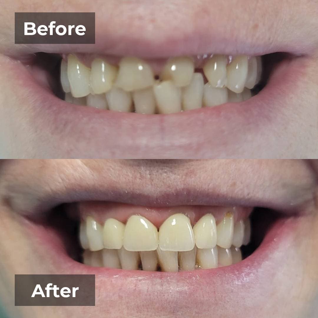 Smile transformation gallery photo 13 of 27