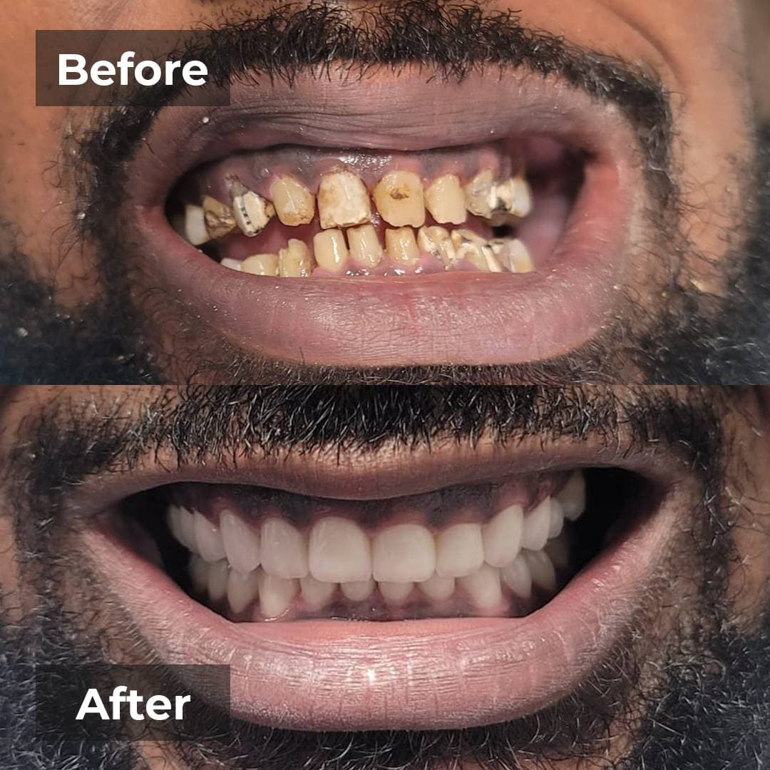 Smile transformation gallery photo 14 of 27