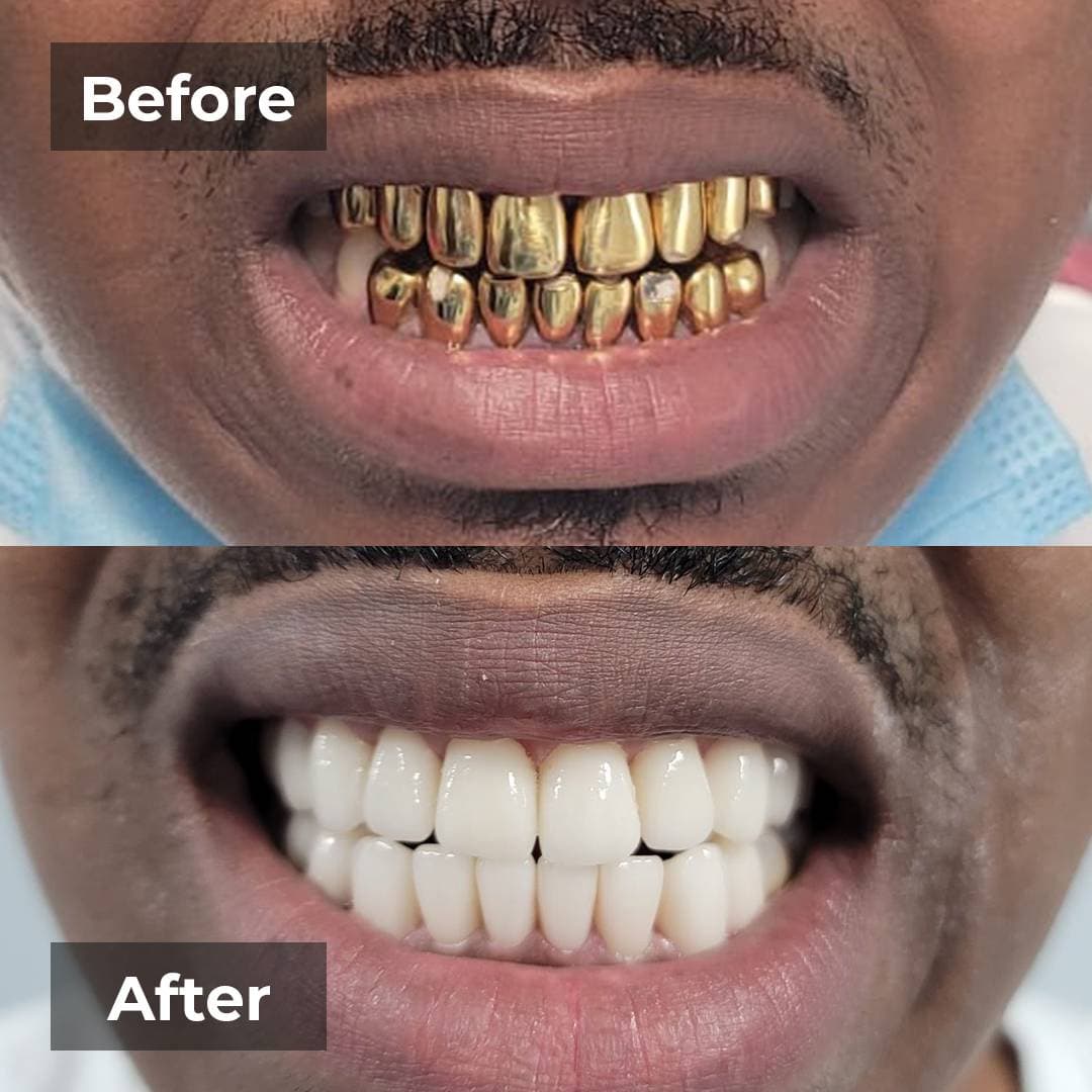 Smile transformation gallery photo 15 of 27
