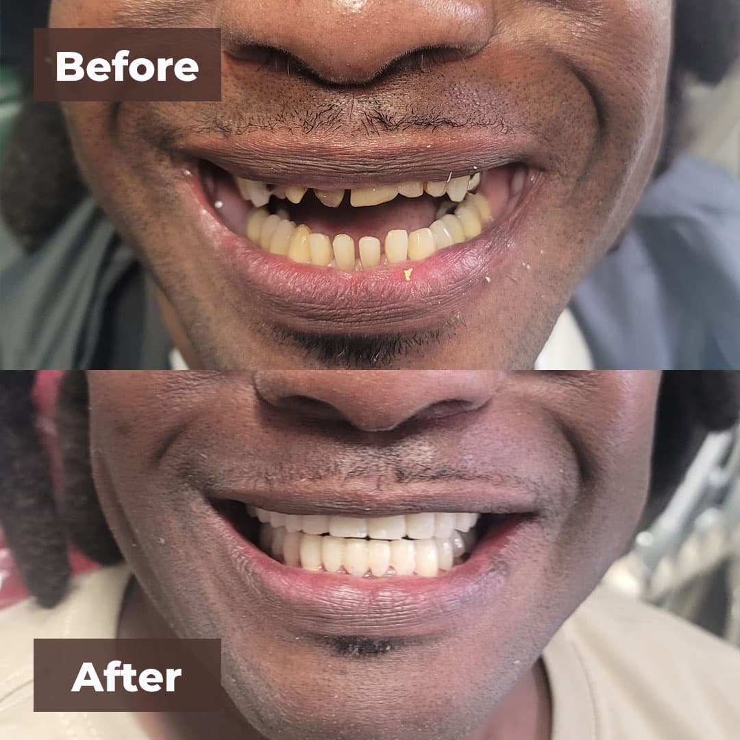 Smile transformation gallery photo 16 of 27