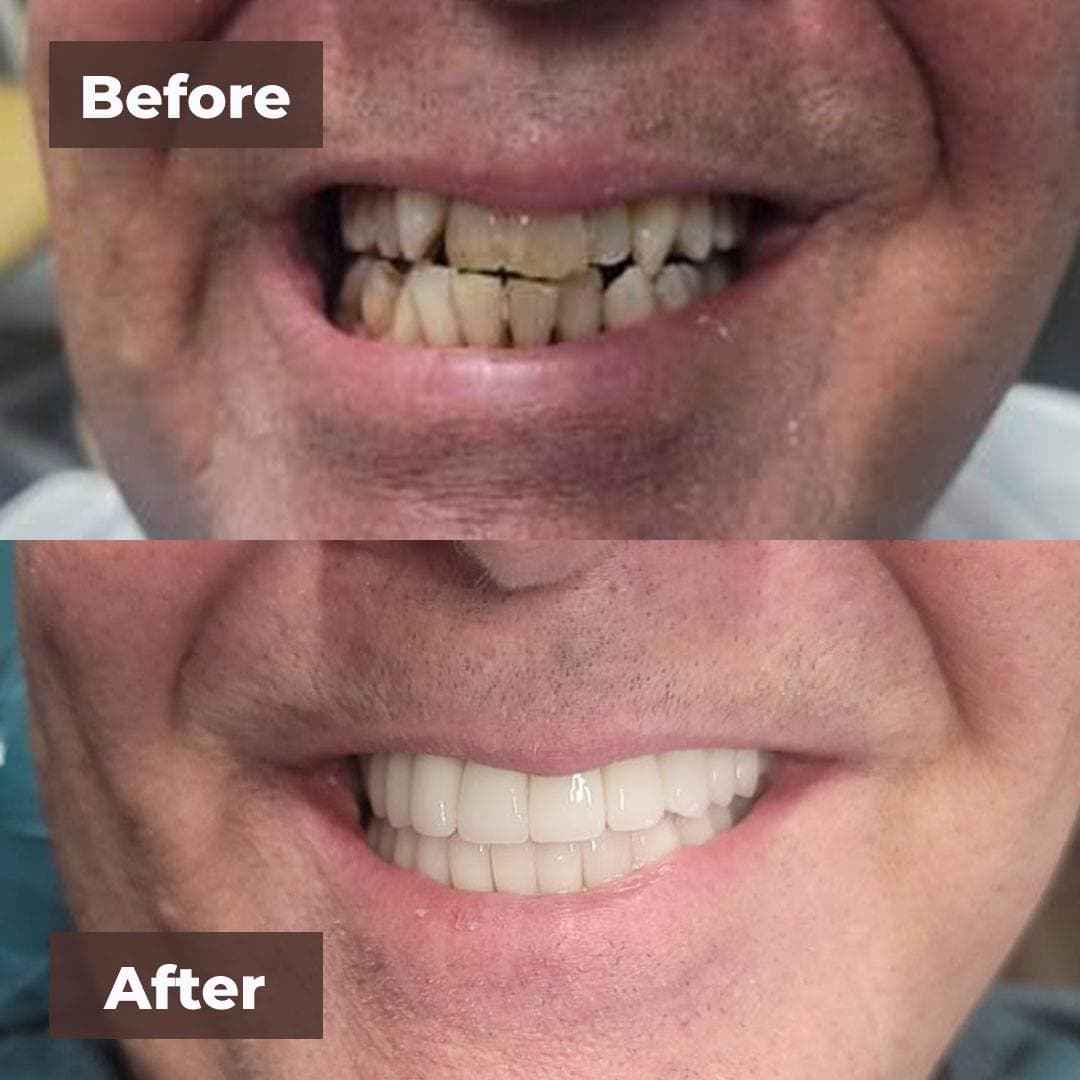Smile transformation gallery photo 17 of 27
