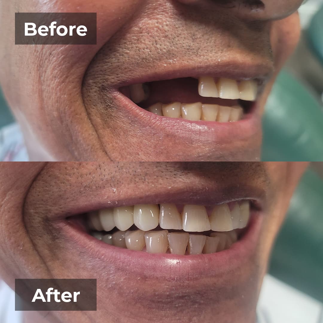 Smile transformation gallery photo 18 of 27