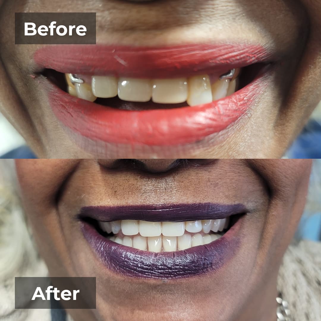 Smile transformation gallery photo 19 of 27