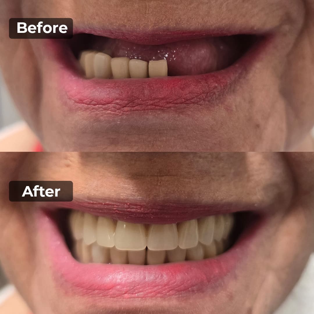 Smile transformation gallery photo 2 of 27