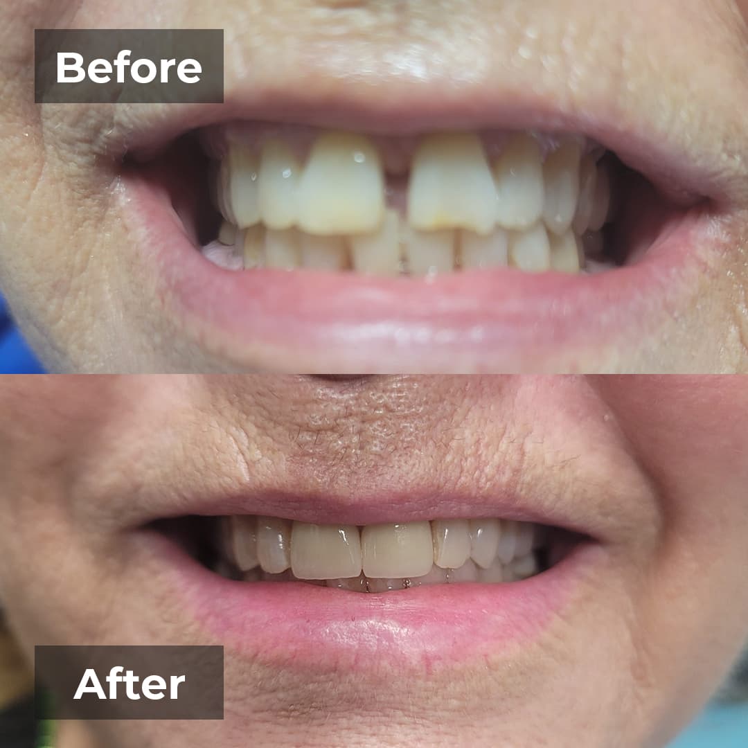 Smile transformation gallery photo 20 of 27