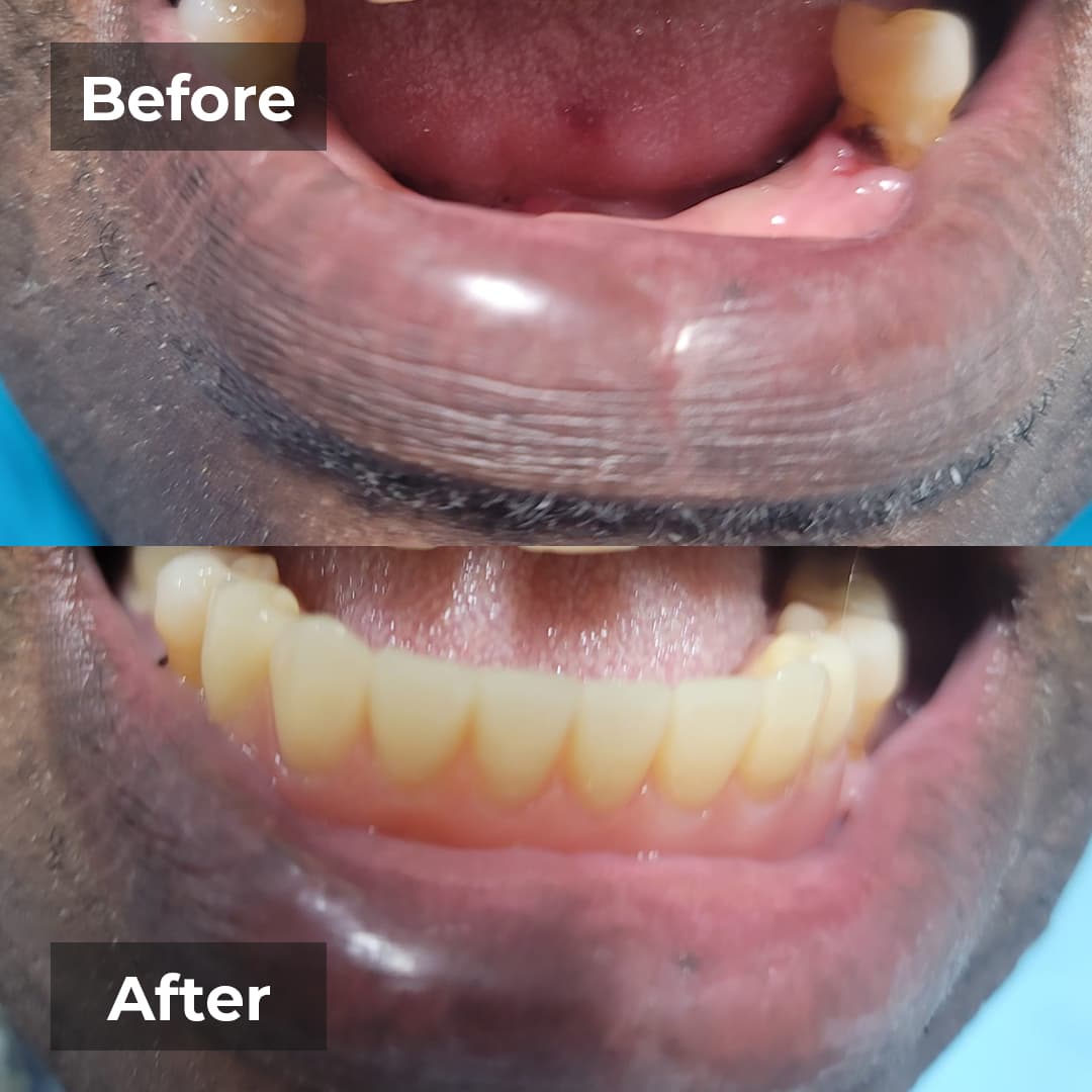 Smile transformation gallery photo 22 of 27