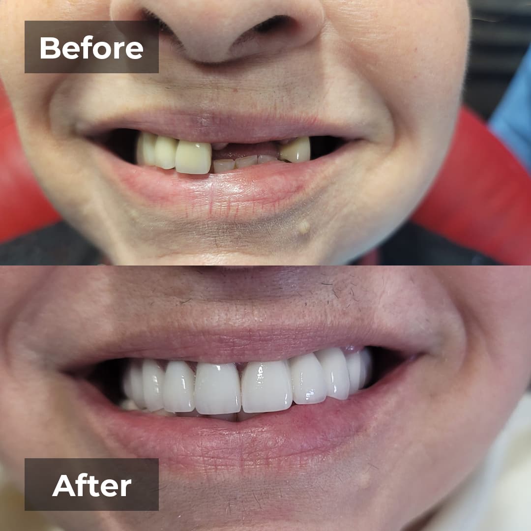 Smile transformation gallery photo 23 of 27