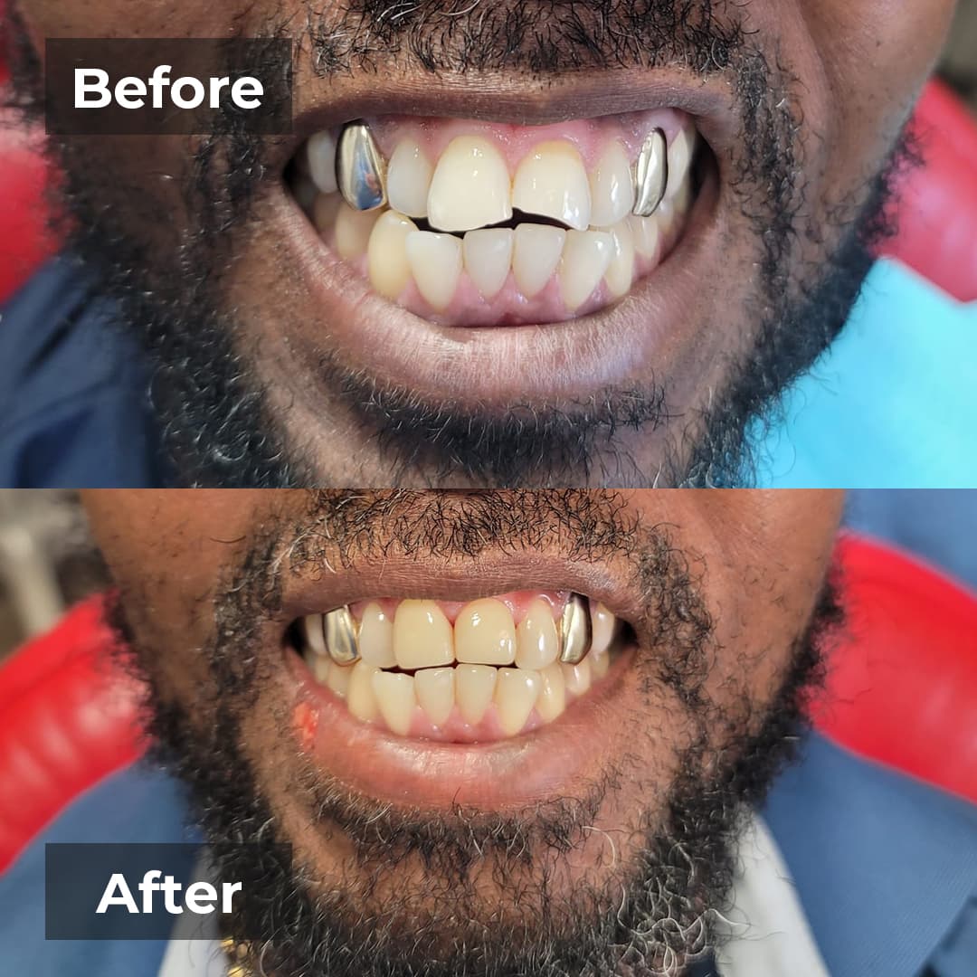 Smile transformation gallery photo 24 of 27