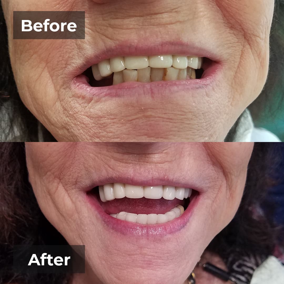 Smile transformation gallery photo 25 of 27