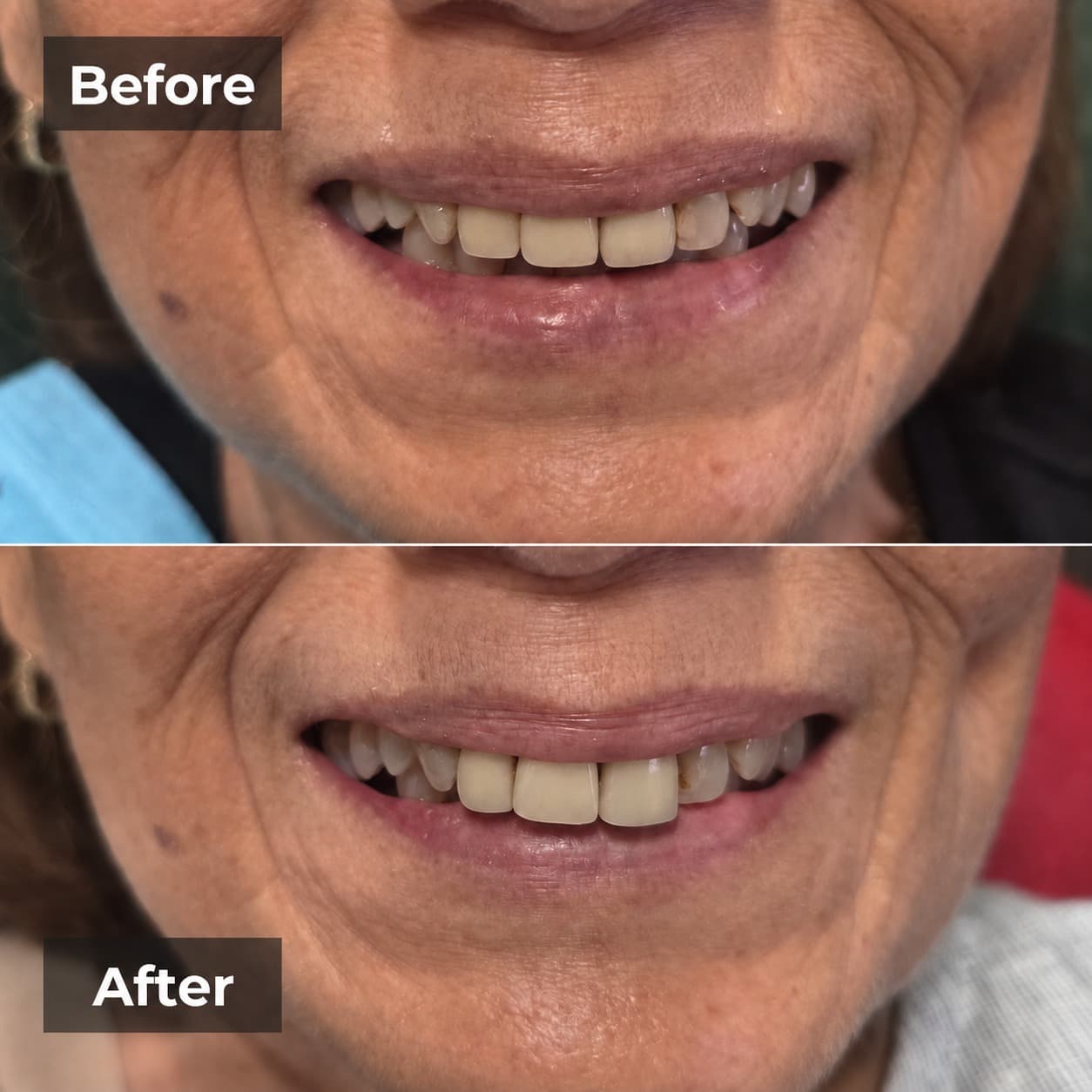 Smile transformation gallery photo 26 of 27