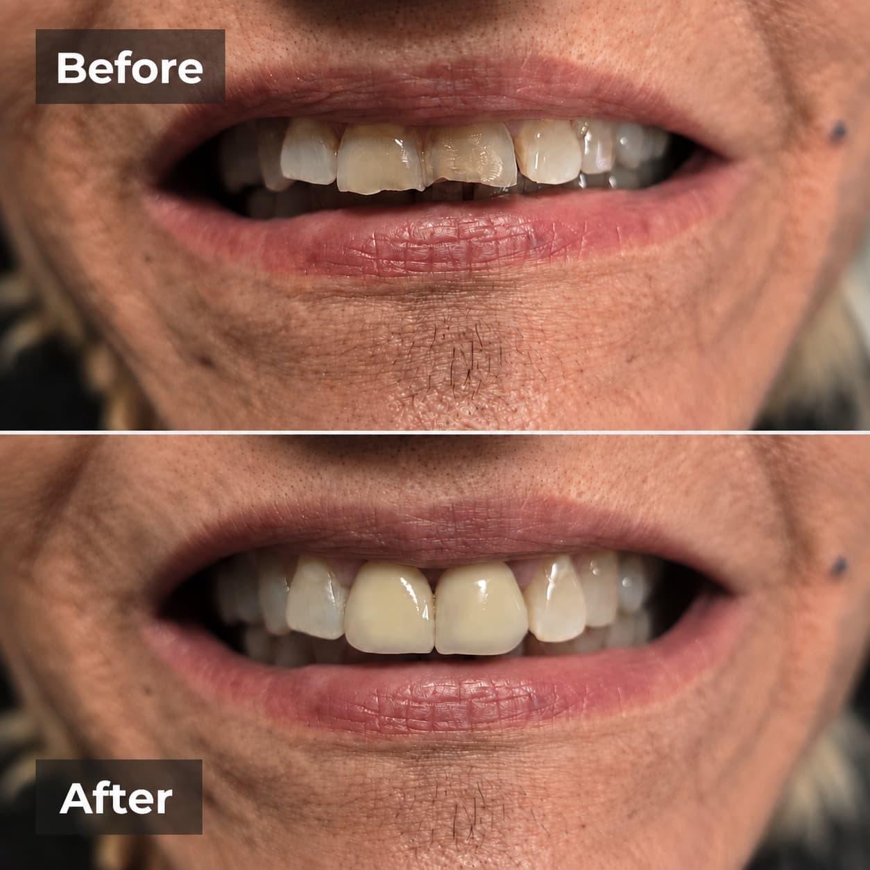 Smile transformation gallery photo 27 of 27
