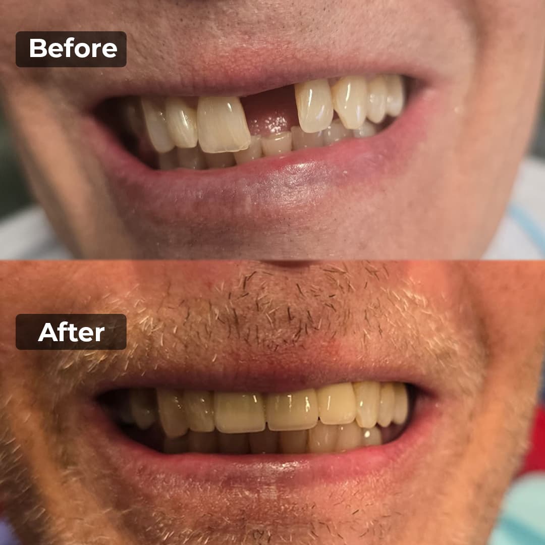 Smile transformation gallery photo 3 of 27