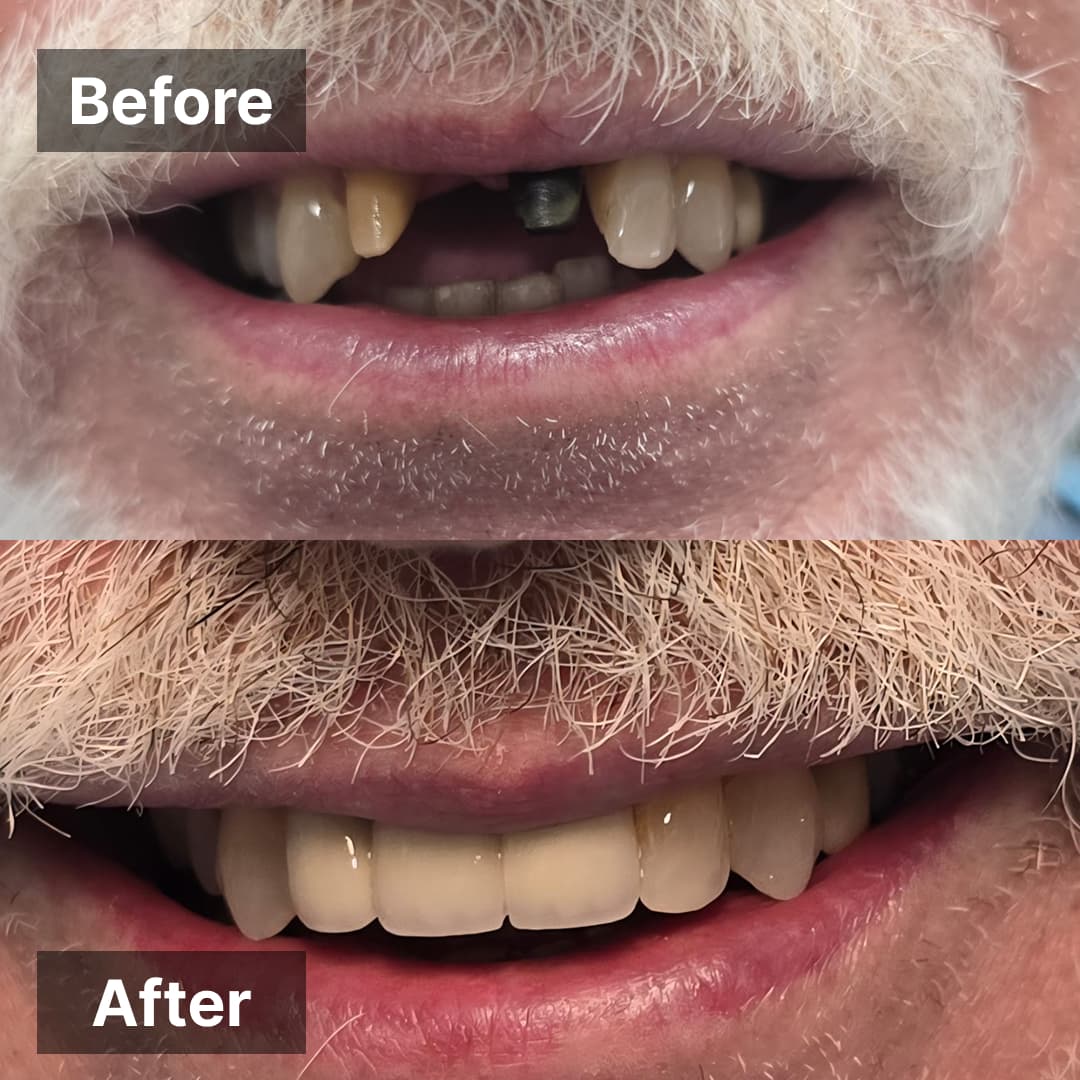 Smile transformation gallery photo 4 of 27