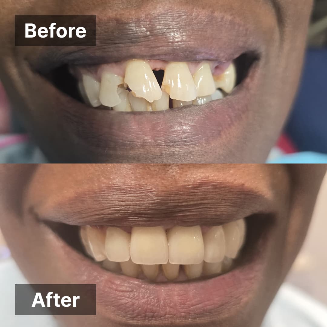 Smile transformation gallery photo 5 of 27