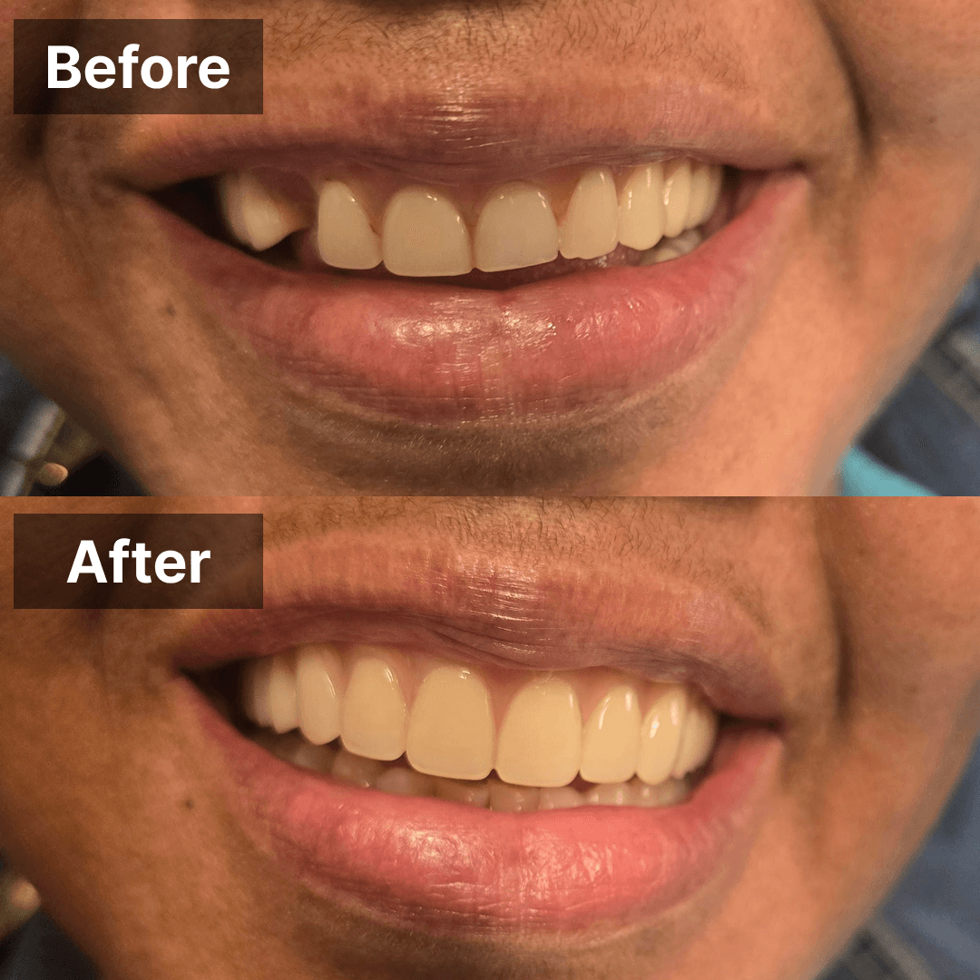 Smile transformation gallery photo 6 of 27