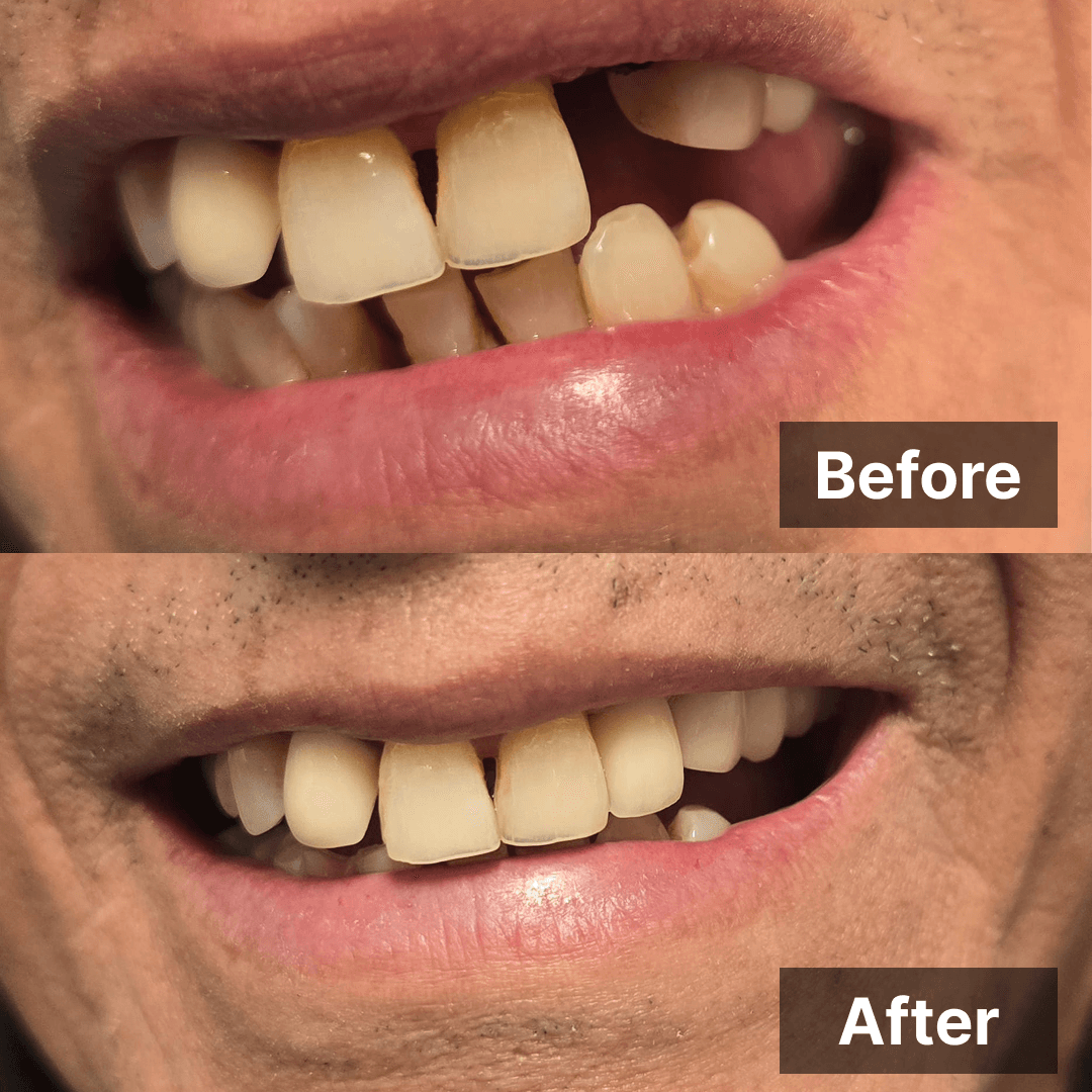 Smile transformation gallery photo 7 of 27