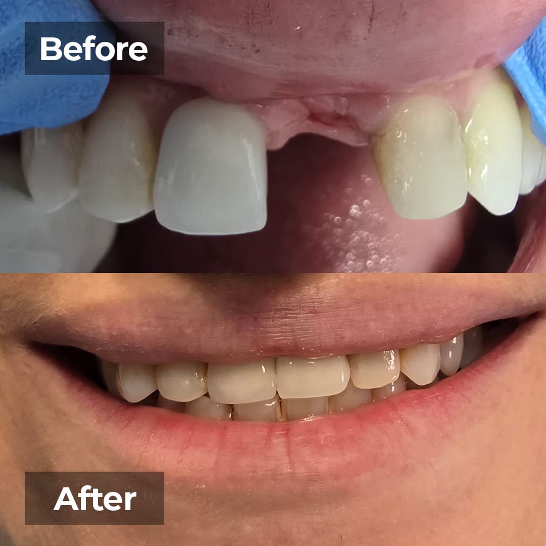 Smile transformation gallery photo 8 of 27