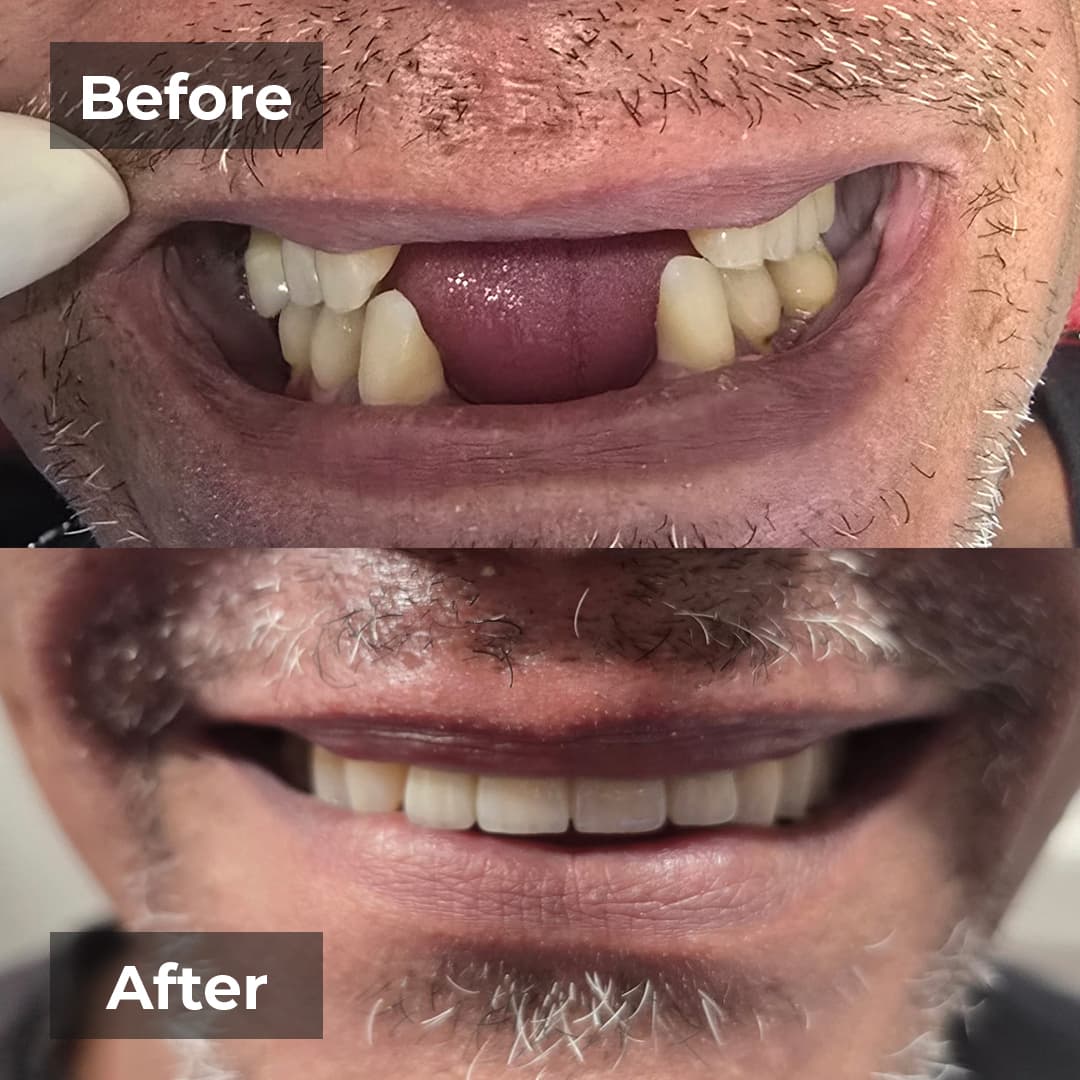 Smile transformation gallery photo 9 of 27