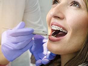 Orthodontic dental care