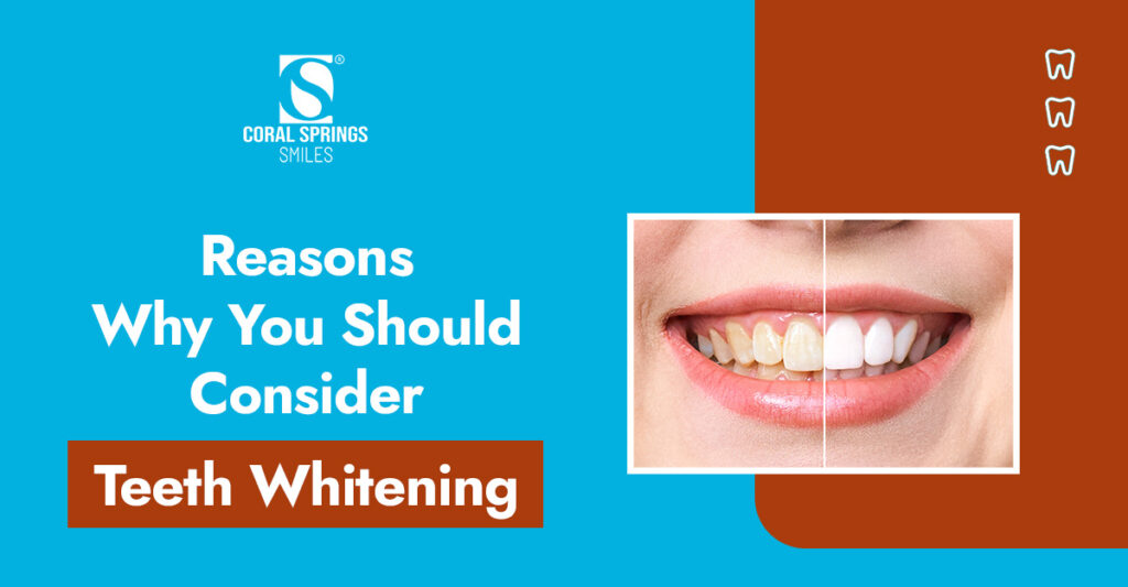 Consider Teeth Whitening